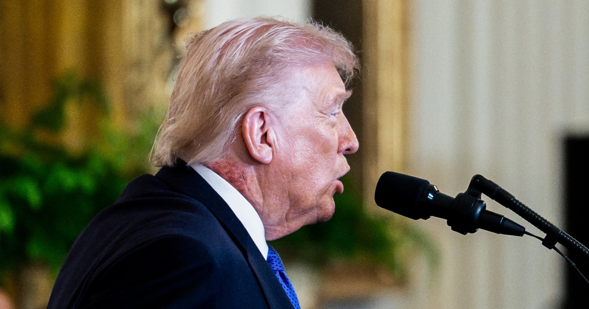 Donald Trump's Red Neck: Doctor Confirms Common Skin Irritation